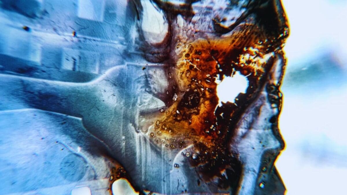 Una pistola que no dispara balas sino que arregla y regenera huesos en tiempo real. Así es la tecnología que promete cambiar la cirugía para siempre