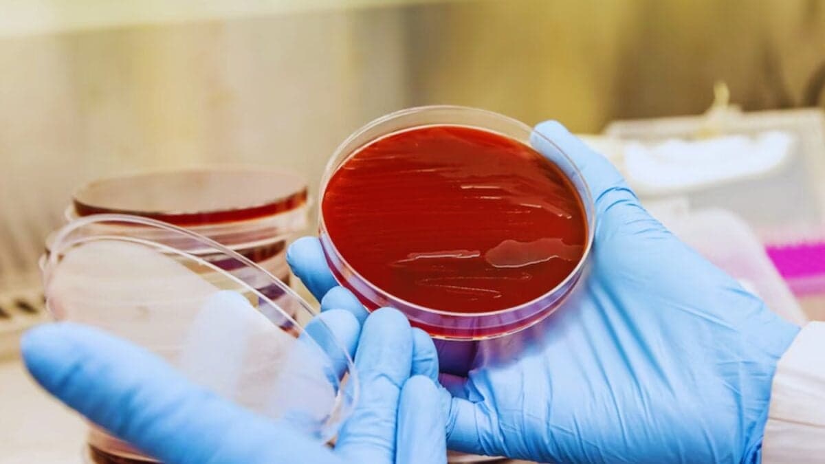 Un bot latinoamericano se adelanta al diagnóstico. Una inteligencia artificial que interpreta bacterias y promete cambiar la salud pública