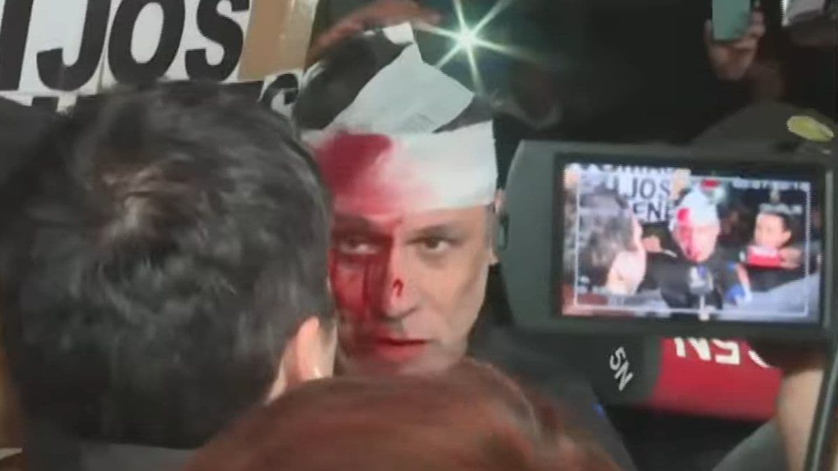 Quién es el periodista que terminó herido en el acto de Javier Milei