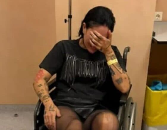 Indira Paganotto se rompe una pierna en pleno set