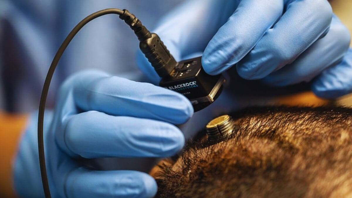 Mientras el mundo se fascina con la inteligencia artificial, China impulsa una tecnología aún más inquietante: chips implantables en el cerebro